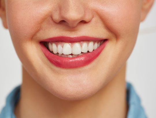 Skaling zębów – na czym polega i dlaczego warto go wykonać?